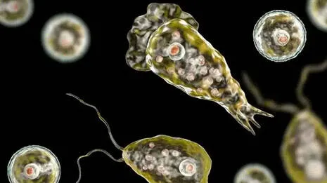 amoebic-meningoencephalit