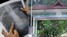 health-department-on-thiruvananthapuram-general-hospital-medical-negligence