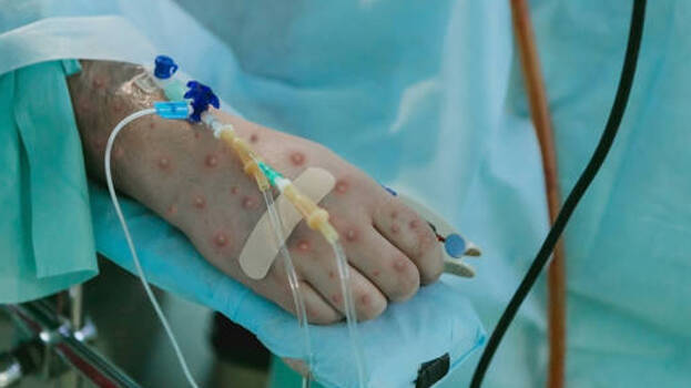 patient patient