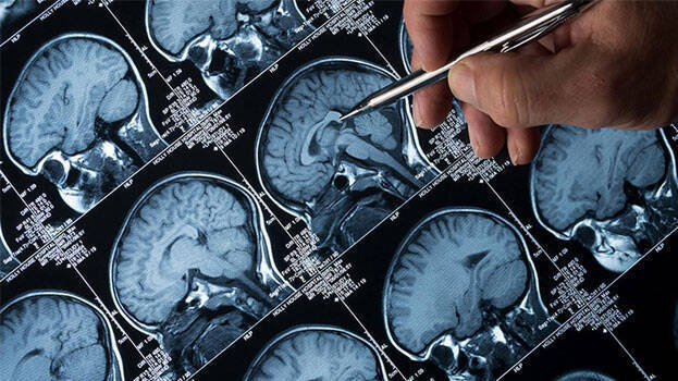 amoebic-meningoencephalit amoebic-meningoencephalit