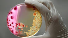 nightmare-bacteria-in-america