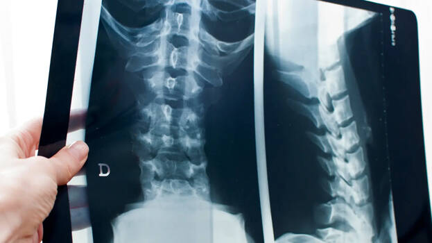xray xray