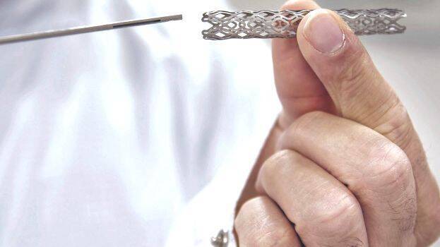 stent