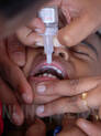 polio
