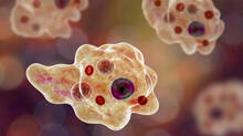 amoebic-meningitis