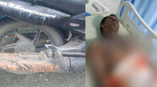 acid-accident-at-kochi-man-severely-burned