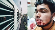 glass-bottle-thrown-from-train-young-man-injured