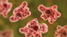 amoebic-encephalitis-women-died-