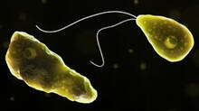 one-more-case-of-amoebic-meningoencephalitis-detected-at-thiruvananthapuram