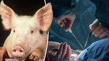 pig-liver-transplants-into-human-body