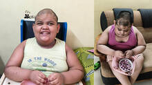 twelve-year-old-boy-overcomes-health-issues-with-alfeys-cuts