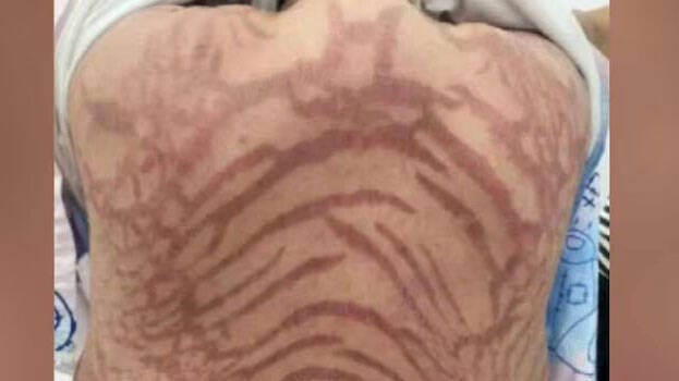 skin-problems skin-problems