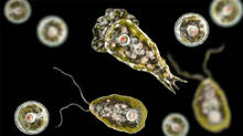 brain-eating-amoeba-case