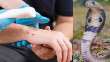 more-than-50-percentage-of-snakebites-are-venomous-says-health-experts