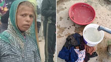 20-children-rescued-from-bee-attack-anganwadi-worker-finally-collapsed-and-died