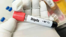 another-case-of-shigella-confirmed-in-thiruvananthapuram