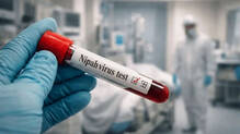 nipah-test-of-three-close-contacts-of-nipah-patient-in-kozhikode-came-negative