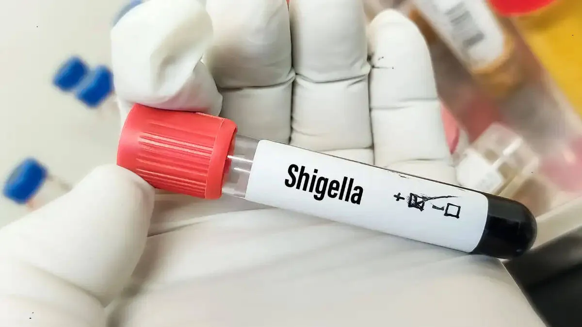 shigella shigella