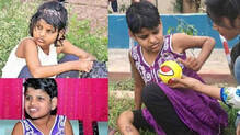 mowgli-girl-who-is-found-in-forest-dies-at-18-in-lucknow-after-years-of-rehabilitation