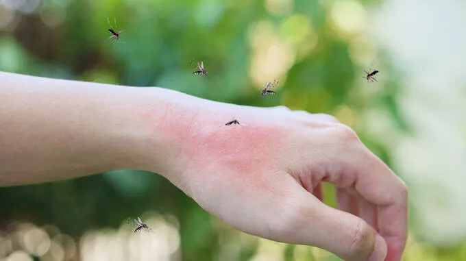 mosquito