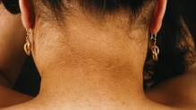 dark-neck
