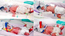 rare-quadruplet-birth-australia-family-of-seven-children-needs-new-van