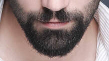 man-spends-10000-dollars-on-beard-transplant-for-confidence