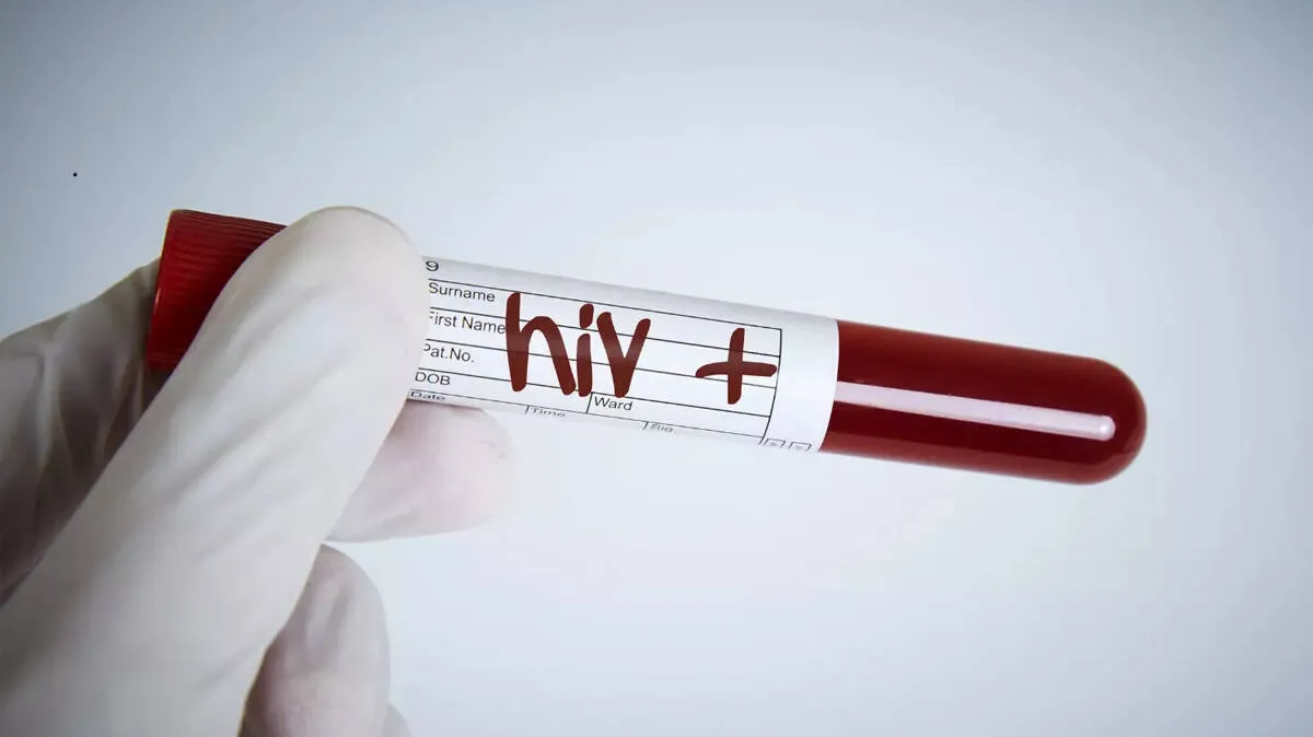 hiv-test