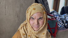 jammu-kashmir-pellet-victim-compensation
