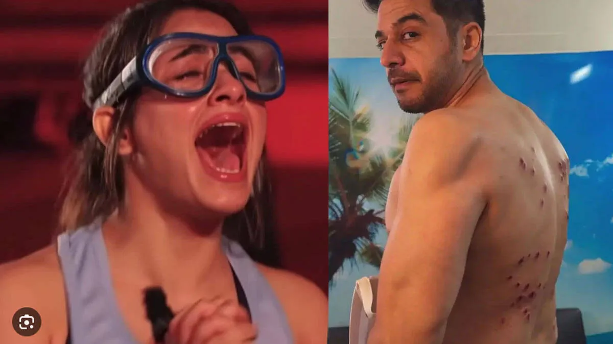 contestants-injured