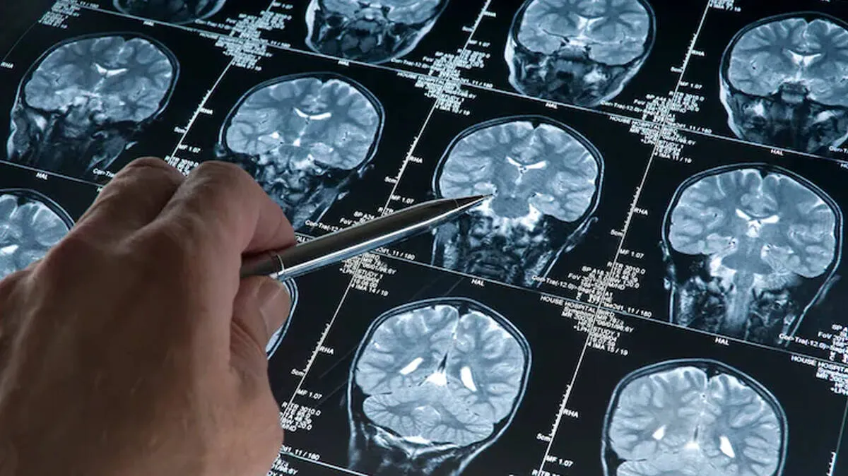mini-human-brains