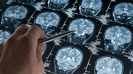 mini-human-brains.1.3975286