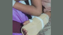 stray-dog-attack---on-4-year-old