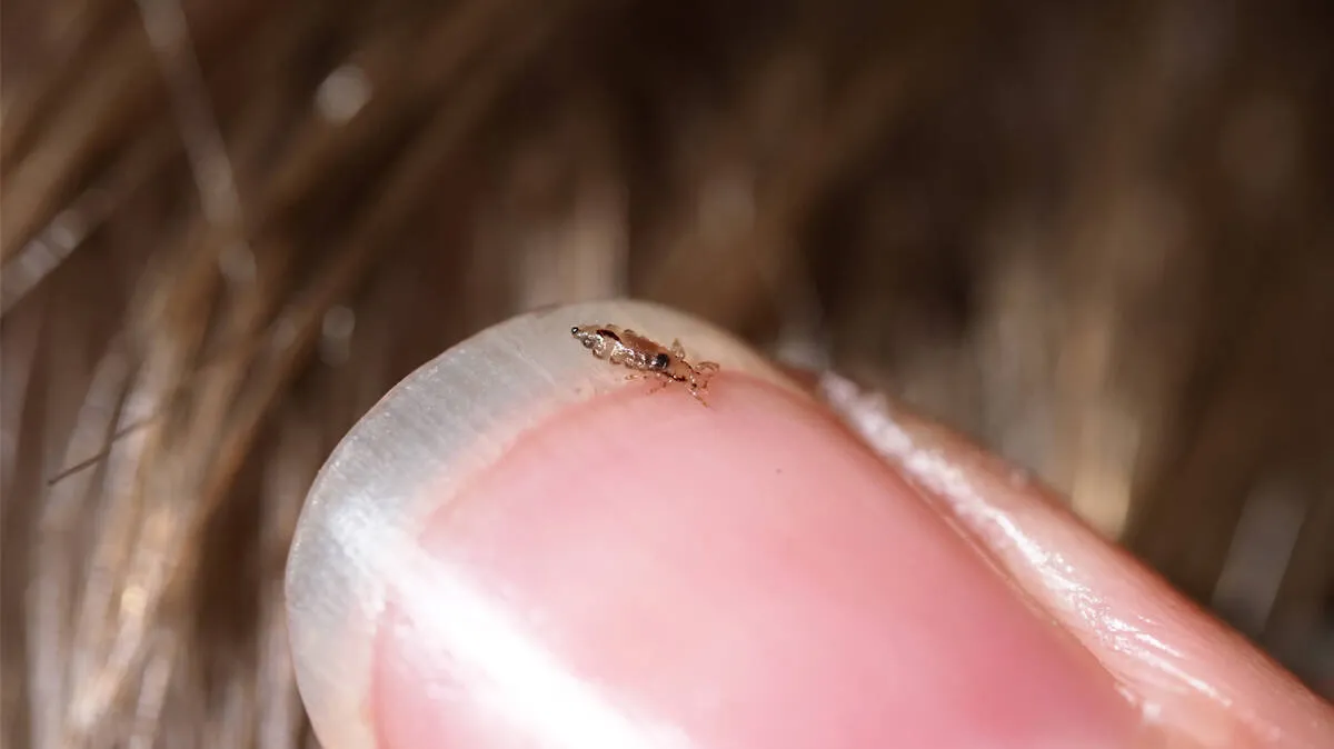 lice-