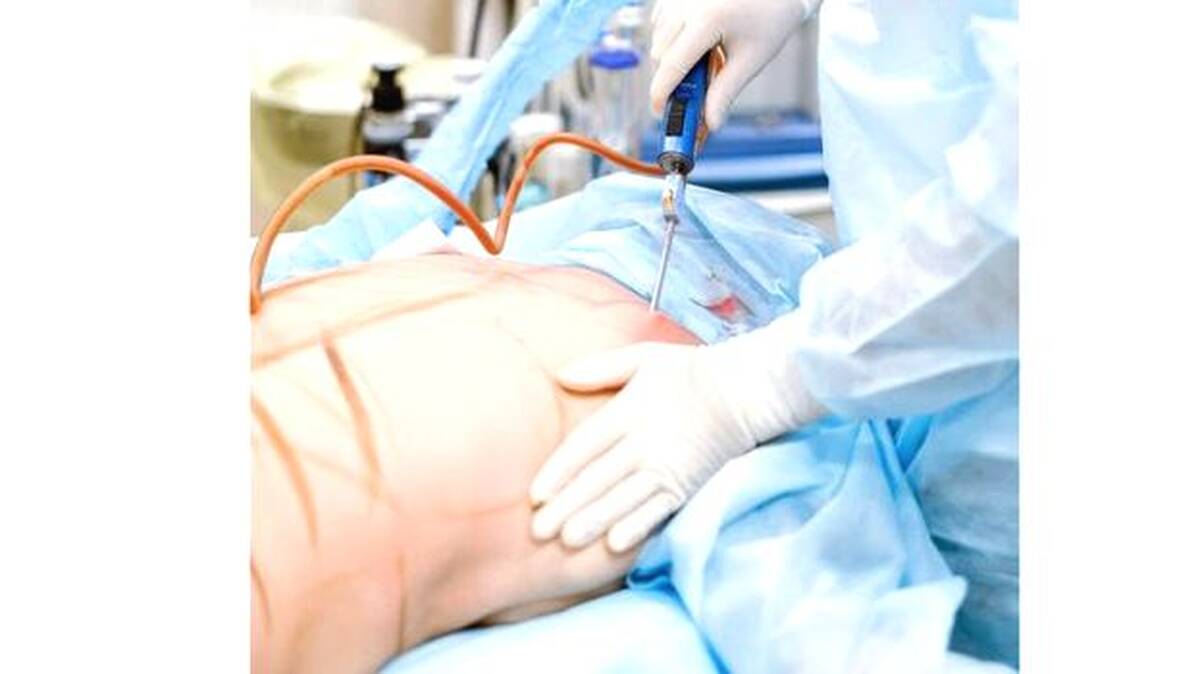 sargery
