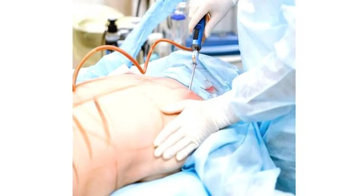 sargery