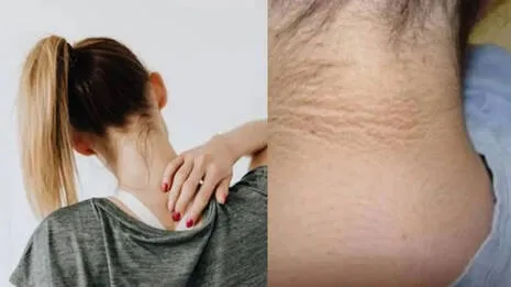 darkl-neck.1.4048197