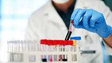 russia-plague-lab-technician-death