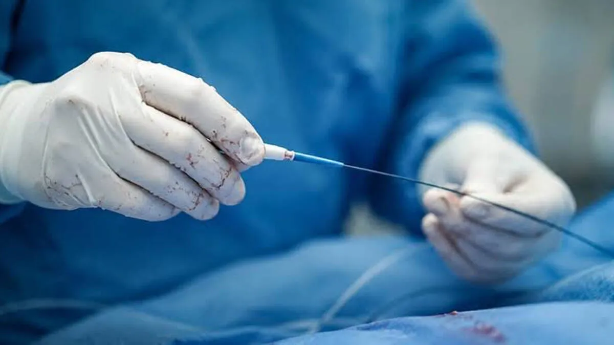 angioplasty