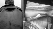 bjp-mla-accused-youth-assault-electric-shock