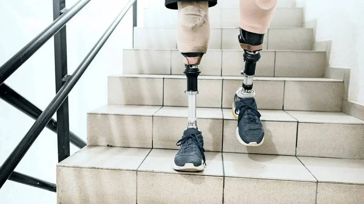 leg leg