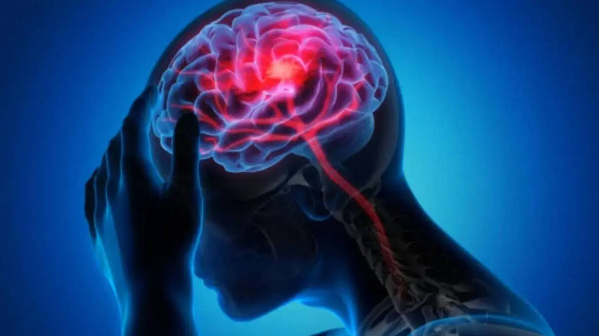 stroke-