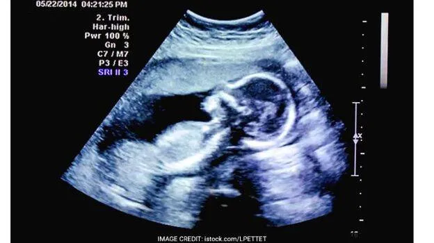 ultra-sound