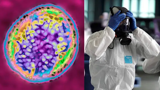 -brucellosis