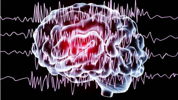 epilepsy