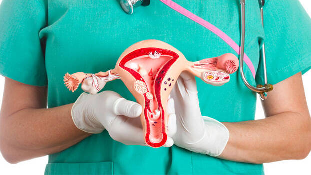 ovarian-cancer-