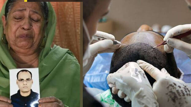 Youth dies in Delhi after hair transplant goes wrong - INDIA - GENERAL |  Kerala Kaumudi Online