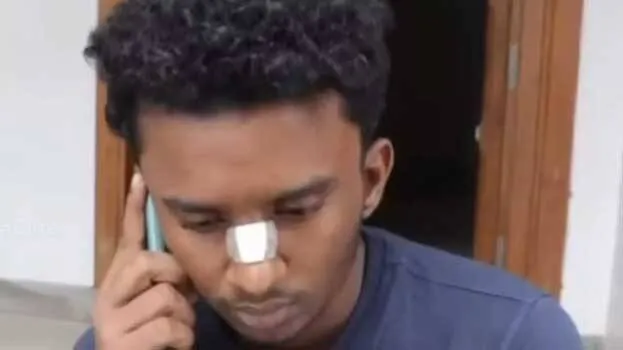 kozhikode-kerala-injury-a