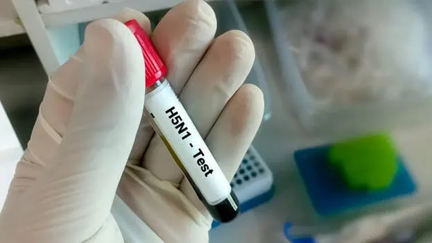 bird-flu