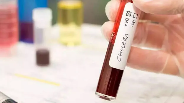 cholera